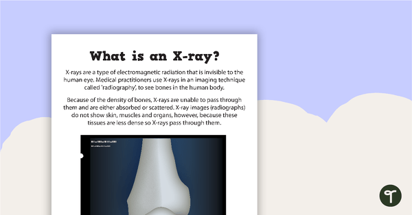 Go to What is an X-ray? - Poster teaching resource