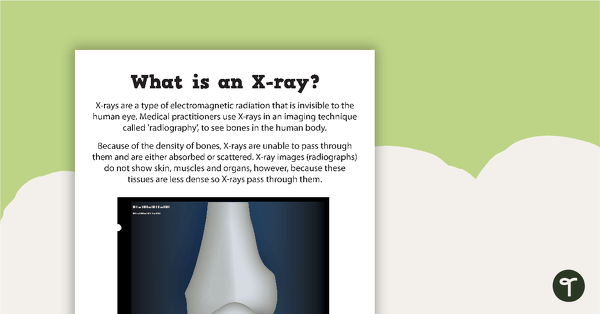 What is an X-ray? - Poster teaching resource